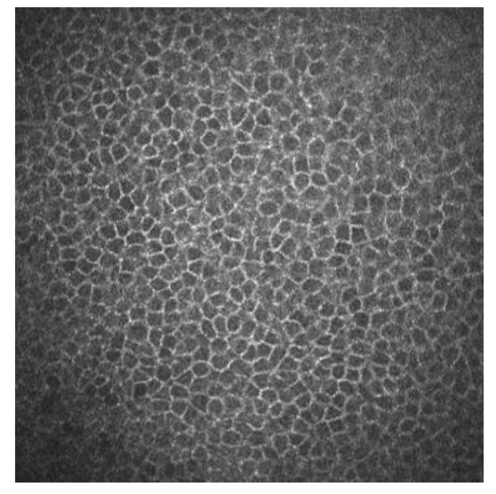 Epithelium